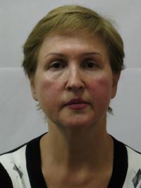 Коваленко Асия Абдульбаровна